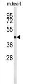 Cyclin Dependent Kinase 19 antibody, LS-C168589, Lifespan Biosciences, Western Blot image 