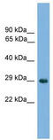 NK1 Homeobox 2 antibody, TA341812, Origene, Western Blot image 