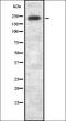 Leucine Rich Repeat Kinase 1 antibody, orb337630, Biorbyt, Western Blot image 