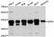 Nucleophosmin 1 antibody, STJ24796, St John