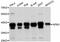 Nucleophosmin 1 antibody, STJ24796, St John