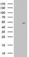 Keratin 20 antibody, LS-C336629, Lifespan Biosciences, Western Blot image 