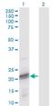 Odontogenic ameloblast-associated protein antibody, H00054959-M02, Novus Biologicals, Western Blot image 