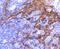 Keratin 6A antibody, NBP2-67705, Novus Biologicals, Immunohistochemistry paraffin image 