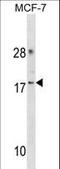 Cyclin Dependent Kinase 2 Associated Protein 2 antibody, LS-C157634, Lifespan Biosciences, Western Blot image 