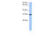 PRX-3 antibody, 30-808, ProSci, Western Blot image 