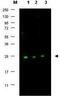 Cyclin Dependent Kinase Inhibitor 1B antibody, GTX26547, GeneTex, Western Blot image 