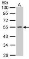 Sphingosine Kinase 1 antibody, PA5-28099, Invitrogen Antibodies, Western Blot image 