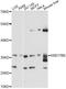 Hydroxysteroid 17-Beta Dehydrogenase 6 antibody, LS-C749476, Lifespan Biosciences, Western Blot image 