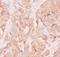 Angio-associated migratory cell protein antibody, LS-C343983, Lifespan Biosciences, Immunohistochemistry paraffin image 