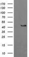 Gamma-Butyrobetaine Hydroxylase 1 antibody, TA505753AM, Origene, Western Blot image 