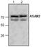 N-Acylsphingosine Amidohydrolase 2 antibody, GTX59675, GeneTex, Western Blot image 