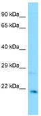 CXXC Finger Protein 4 antibody, TA337976, Origene, Western Blot image 