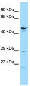 Spermatogenesis Associated 6 antibody, TA335407, Origene, Western Blot image 