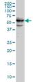 Cytidine And DCMP Deaminase Domain Containing 1 antibody, H00081602-M01, Novus Biologicals, Western Blot image 