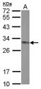 Caseinolytic Mitochondrial Matrix Peptidase Proteolytic Subunit antibody, NBP2-15919, Novus Biologicals, Western Blot image 