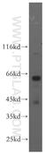 Phosphatidylinositol Glycan Anchor Biosynthesis Class Z antibody, 17384-1-AP, Proteintech Group, Western Blot image 