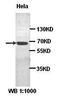 EPH Receptor A4 antibody, orb76979, Biorbyt, Western Blot image 