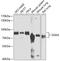 Diacylglycerol Kinase Alpha antibody, 22-536, ProSci, Western Blot image 