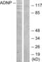 Activity Dependent Neuroprotector Homeobox antibody, abx013792, Abbexa, Western Blot image 