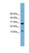 TAL BHLH Transcription Factor 2 antibody, NBP1-80224, Novus Biologicals, Western Blot image 