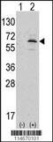 NEDD8 Activating Enzyme E1 Subunit 1 antibody, 62-787, ProSci, Western Blot image 