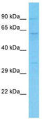 Retrotransposon-derived protein PEG10 antibody, TA339187, Origene, Western Blot image 