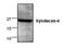 Syndecan 4 antibody, NB110-41551, Novus Biologicals, Western Blot image 