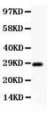 Synaptonemal Complex Protein 3 antibody, LS-C357444, Lifespan Biosciences, Western Blot image 