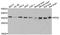 Ribosomal Protein S2 antibody, A6728, ABclonal Technology, Western Blot image 