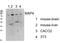 Microtubule Associated Protein 4 antibody, A00948-1, Boster Biological Technology, Western Blot image 
