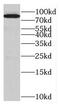 EPS8 Like 2 antibody, FNab02820, FineTest, Western Blot image 