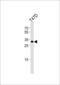 Inhibitor Of Growth Family Member 4 antibody, 61-026, ProSci, Western Blot image 