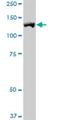 Receptor Tyrosine Kinase Like Orphan Receptor 1 antibody, H00004919-M01, Novus Biologicals, Western Blot image 