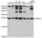 Ubiquitin Conjugating Enzyme E2 K antibody, LS-C331249, Lifespan Biosciences, Western Blot image 