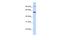 Transportin 2 antibody, A09832, Boster Biological Technology, Western Blot image 