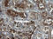 Fibrinogen Gamma Chain antibody, LS-C788459, Lifespan Biosciences, Immunohistochemistry paraffin image 