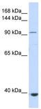 Helicard antibody, TA341618, Origene, Western Blot image 