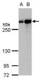 Filamin A antibody, GTX112939, GeneTex, Western Blot image 