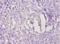 Transmembrane Protein 14B antibody, LS-C285628, Lifespan Biosciences, Immunohistochemistry paraffin image 