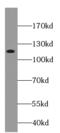 Cadherin 10 antibody, FNab01546, FineTest, Western Blot image 