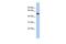 Acid Sensing Ion Channel Subunit 2 antibody, GTX47614, GeneTex, Western Blot image 