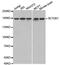 SET Domain Bifurcated Histone Lysine Methyltransferase 1 antibody, MBS126067, MyBioSource, Western Blot image 