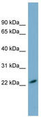 Matrix Remodeling Associated 7 antibody, TA336144, Origene, Western Blot image 