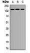 Protein Tyrosine Phosphatase Non-Receptor Type 21 antibody, orb304532, Biorbyt, Western Blot image 