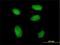 Remodeling And Spacing Factor 1 antibody, H00051773-M05, Novus Biologicals, Immunocytochemistry image 