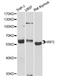 Interferon Regulatory Factor 5 antibody, A1149, ABclonal Technology, Western Blot image 