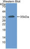 Carcinoembryonic Antigen Related Cell Adhesion Molecule 1 antibody, abx131792, Abbexa, Western Blot image 