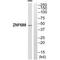 Zinc Finger Protein 785 antibody, A17049, Boster Biological Technology, Western Blot image 