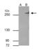 Tet Methylcytosine Dioxygenase 2 antibody, GTX629881, GeneTex, Immunoprecipitation image 